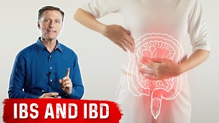 FODMAPS and Irritable Bowel Syndrome [upl. by Alacim]