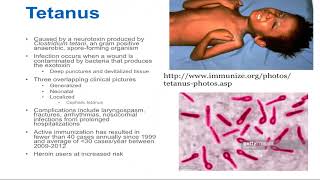 Tetanus  Epidemiology and Associated Complications [upl. by Eihcra218]