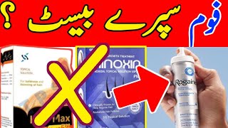 Rogaine Foam Spray 100 Result  How To Apply Monxidil Spray [upl. by Ahsaya321]