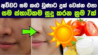 අව්වට කළු වුණු සම නැවත තිබුණා වගේම සුදු කර ගන්න ක් රම 07ක්  HOW TO RECOVER SUN BURNS [upl. by Nitsur]