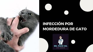 Infección por mordedura de gato ¿Más peligroso de lo esperado [upl. by Benedikta460]