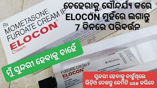 ମୁଁ ସୁନ୍ଦରୀ ହେବାକୁ ଚାହେଁ  Elocon  Mometasone Furoate Cream  ଚେହେରା ସୌନ୍ଦର୍ଯ୍ୟ ବଢ଼ାନ୍ତୁ 7ଦିନରେ [upl. by Levesque781]