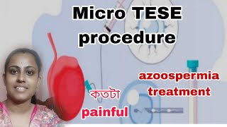 Micro TESE procedureকতটা painfulAzoospermia treatment in IVF [upl. by Wall]