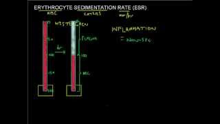 ESR made easy  Erythrocyte Sedimentation Rate  Full Blood Count Masterclass series [upl. by Gilmer]