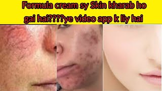 Skin Whitening Cream  Skin Repairing cream  Acne amp pigmentation Cream  Real beauty Secrets [upl. by Finny940]