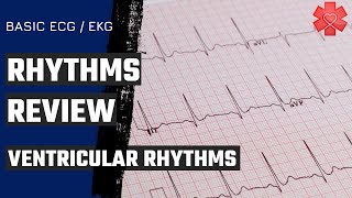 Basic ECG EKG Part 4 Ventricular Rhythms [upl. by Di619]