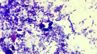 Cyniclomyces guttulatus in fecal cytology [upl. by Ranger]