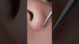 immersive skin care strawberry nose blackhead deep pore cleaning skin management [upl. by Nesila]