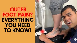 Outer Foot Pain  Everything You Need To Know About Cuboid Syndrome [upl. by Aldo852]