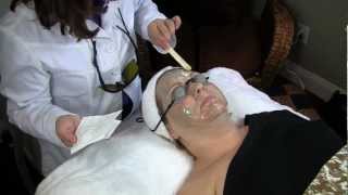 IPL Intense Pulsed Light Facial Laser Treatment [upl. by Oakes]