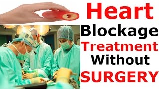 Heart blockage treatment without surgery  Natural Home Remdies As Medicine For ANGIOPLASTY [upl. by Potts]