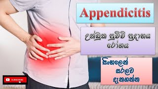 Appendicitis උන්ඩුක පුච්චි ප්‍රදාහය රෝග causes how it happens treatment sinhala how to prevent [upl. by Ettenig]