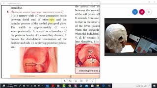 Limiting structures of maxillary arch Part 2 [upl. by Begga]