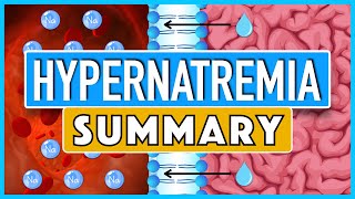 Hypernatremia Summary [upl. by Ennayk]