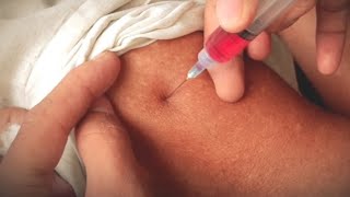 Injection lagane ka tarika  how to give intramuscular injection  nursing school Ep05 [upl. by Lejeune122]