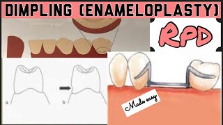 DIMPLING ENAMELOPLASTY II PROSTHETIC MOUTH PREPARATION II REMOVABLE PARTIAL DENTURE I PROSTHODONTICS [upl. by Laamaj]