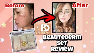 BEAUTEDERM Set Review  Beautederm Before and After  How to use Beautederm Set [upl. by Oigres]