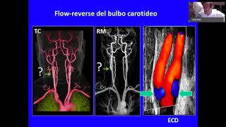 Ultrasound Week School  ECOSU101 lezione 19 [upl. by Ackerman]