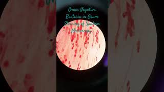 Gram Negative Bacteria in Gram Staining of Sputum Microscopy at various magnifications [upl. by Fini]