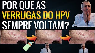 Por que as VERRUGAS DE HPV não somem depois do tratamento [upl. by Danit]