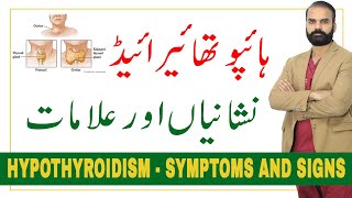 Hypothyroidism Symptoms and signs in UrduHindi [upl. by Eilzel816]