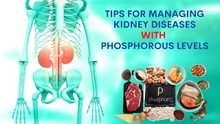 Tips to Manage Kidney diseases Phosphorus and Your Diet High and Low phosphorus foods [upl. by Direj]