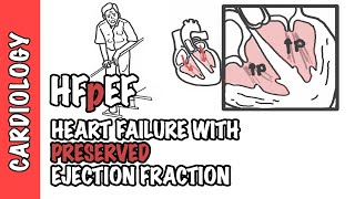 HFpEF  Heart Failure with Preserved Ejection Fraction [upl. by Salisbarry]