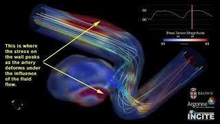 Investigating FlowStructure Interactions in Cerebral Aneurysms [upl. by Rifkin888]