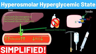 Hyperosmolar Hyperglycemic Nonketotic Syndrome  Panmedicad [upl. by Angelle]