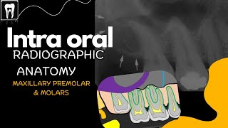 Intra Oral Anatomy Normal radiographic anatomical landmarksMaxilla premolar and molar region [upl. by Zubkoff781]