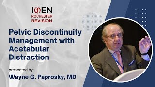 Pelvic Discontinuity Management with Acetabular Distraction  Wayne G Paprosky MD [upl. by Irek]