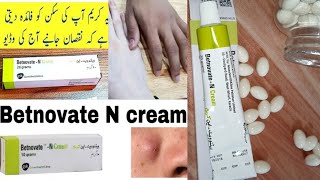 How to use BetnovateN cream on my skin BetnovateN cream review BetnovateN cream uses for skin [upl. by Rambow]