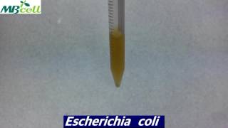 Enterobacteriaceae Enrichment Broth [upl. by Kiyohara65]