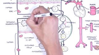 Vasculitis Pathophysiology Overview [upl. by Renfred]