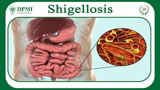 Shigellosis What Causes Shigellosis Shigella Morphology Classification Transmission amp Treatment [upl. by Blum897]