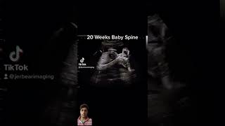 20 week baby kicking in womb shorts fetaldevelopment babydevelopment [upl. by Ruel239]