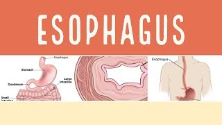 PATHOLOGY OF ESOPHAGUS  GI PATHOLOGY  The White Army [upl. by Thorny]