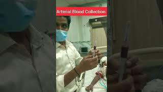 Arterial Blood Collection Artery Se Blood Kaise Nikale trending shorts viral youtubeshorts [upl. by Novets]