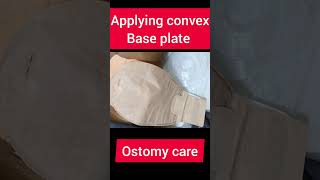 Stoma bag applied [upl. by Asyral]