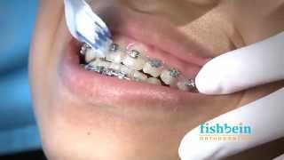 Orthodontic Home Care Instructions  Braces  Brushing [upl. by Frodine]