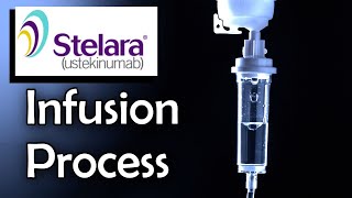 Stelara Infusion Process Ulcerative Colitis Treatment [upl. by Normi]