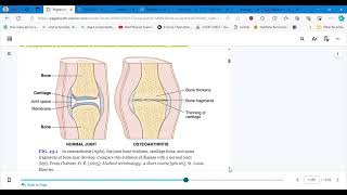 4346 CONCEPTS OF CARE FOR PTS WITH ARTHRITIS AND TOTAL JOINT ARTHROPLASTY PART 1 [upl. by Elladine]