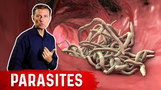 The Best Herbs for Parasites [upl. by Ranilopa]