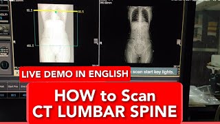 Lumbar Spine CT scan protocol positioning and planning  Dorso Lumbar Spine  Live Demo in English [upl. by Terry]