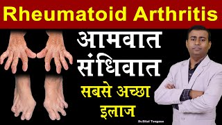 rheumatoid arthritis आमवात संधिवात सबसे अच्छा इलाज I rheumatoid arthritis in hindi [upl. by Sasha91]