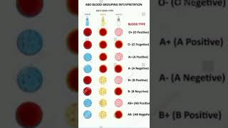 How to perform blood group test medicallaboratory [upl. by Ahron]