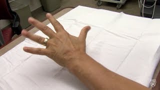 Mayo Clinic Minute What may be causing your hands and feet to tingle [upl. by Hawkie]