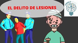 EL DELITO DE LESIONES [upl. by Edik]