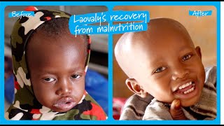 Laoualy’s recovery from severe malnutrition in Niger  UNICEF [upl. by Ahsieyn]