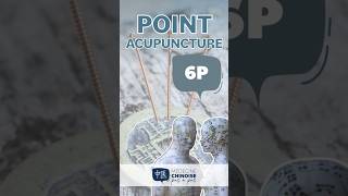 POINT D’ACUPUNCTURE  6P  Kong Zui acupuncture acupuncturepoints medecinechinoise [upl. by Schlessinger]